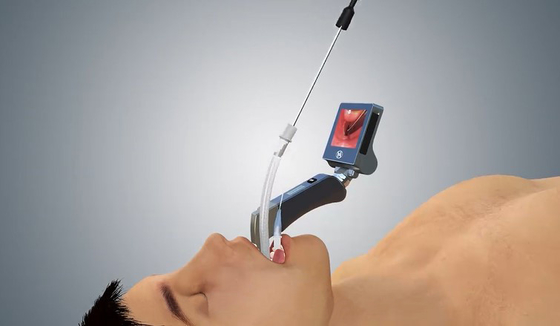 بخش بیهوشی قابل حمل Haiye Video Laryngoscope 1060 Hpa