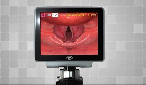 لارنگوسکوپ بصری نمایشگر دسته 3.0 اینچی برای لوله گذاری راه هوایی بالینی اورژانس ICU