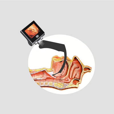 لارنگوسکوپ تصویری قابل استفاده مجدد 8G SD CARD