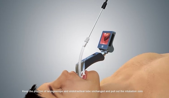 Haiye Medical Laryngoscope ویدئویی یکبار مصرف USB EMS با 6 تیغه فلزی